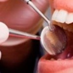 Tratamento de prevenção ajuda a manter os dentes saudáveis e fortes