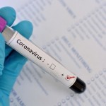 Plano de Saúde é obrigado a custear as despesas dos exames para coronavírus